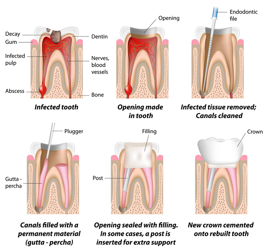 Dental Treatment in Mirpur, Dhaka, Bangladesh 3 image
