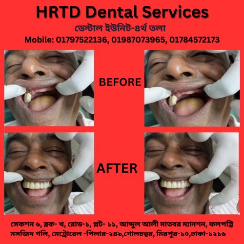 দাঁতের চিকিৎসা কেন্দ্র মিরপুর-১০, ঢাকা 2 HRTD Dental Services 1