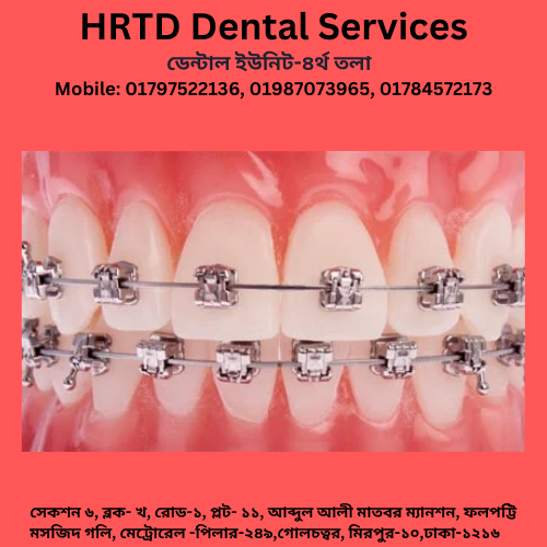 Orthodontic Treatment (দাঁতের সোজা করার চিকিৎসা) 1 HRTD Dental Services 2