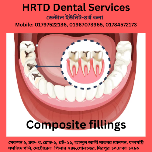 কম্পোজিট ফিলিং (Composite Filling) 1 HRTD Dental Services