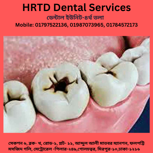 দাঁতে মাড়ির রোগের কারণ, লক্ষণ ও প্রতিকার 1 HRTD Dental Services 4