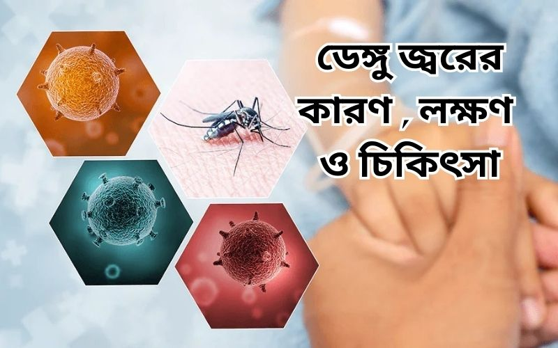 ডেঙ্গু জ্বর: কারণ, লক্ষণ ও করণীয় (Dengue Fever: Causes, Symptoms and What to Do) 1 image 4