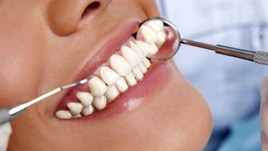 অল-সেরামিক ক্যাপ (All-Ceramic Crown): একটি আধুনিক, প্রাকৃতিক ও টেকসই সমাধান 2 image 17