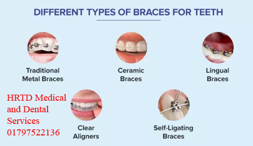 Dental Treatments 2 Types of Braces