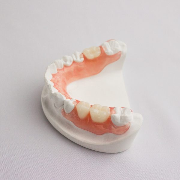 Immediate Flexible Denture 3 image 29