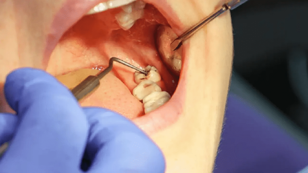 Oral Surgery 4 image 46